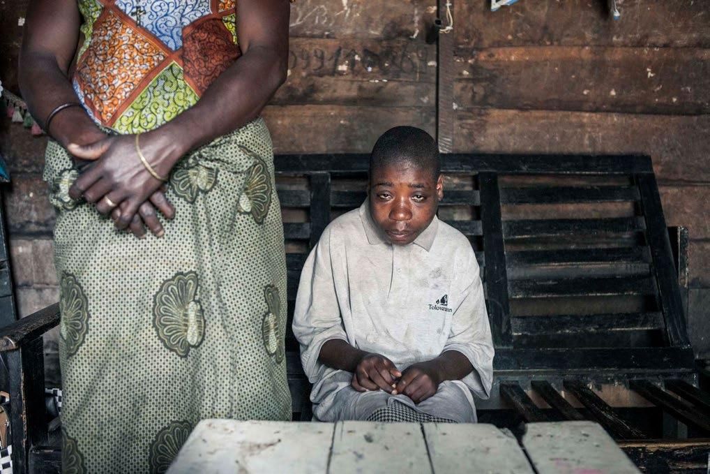Los niños discapacitados como Siuzione son llamados “Biwelele” (idiota inútil).  Foto: Patrick Meinhardt