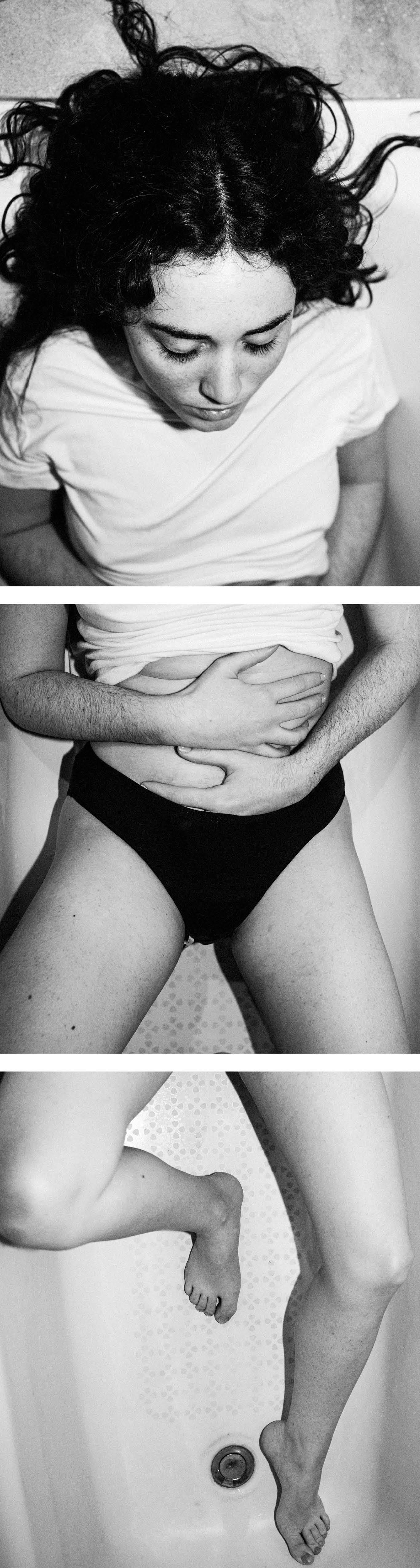 Una de las mujeres que sufre endometriosis fotografiada para la exposición