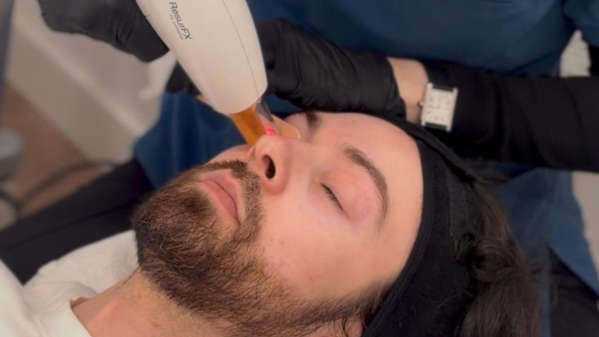 'Bioever Skin: lift and glow', el protocolo que está redefiniendo el rejuvenecimiento facial