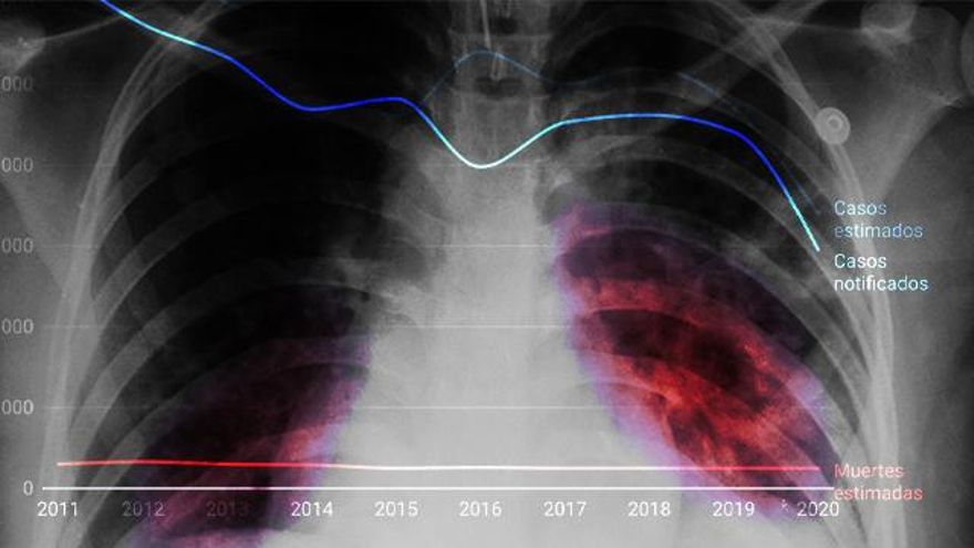 España desanda camino contra la tuberculosis: "Estamos viendo más casos y más graves"