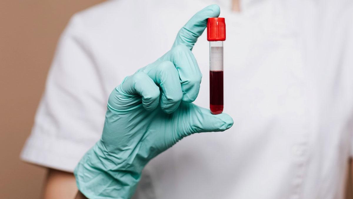 Científicos españoles desarrollan un test de sangre para detectar el cáncer en sus primeros estadios