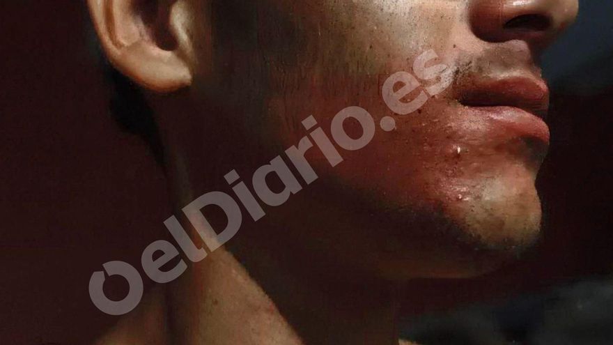Militares rocían con gas pimienta a menores migrantes en Ceuta mientras caminan o vuelven de comprar comida