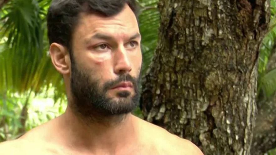 La cara de Jorge Pérez tras la acción de los mosquitos