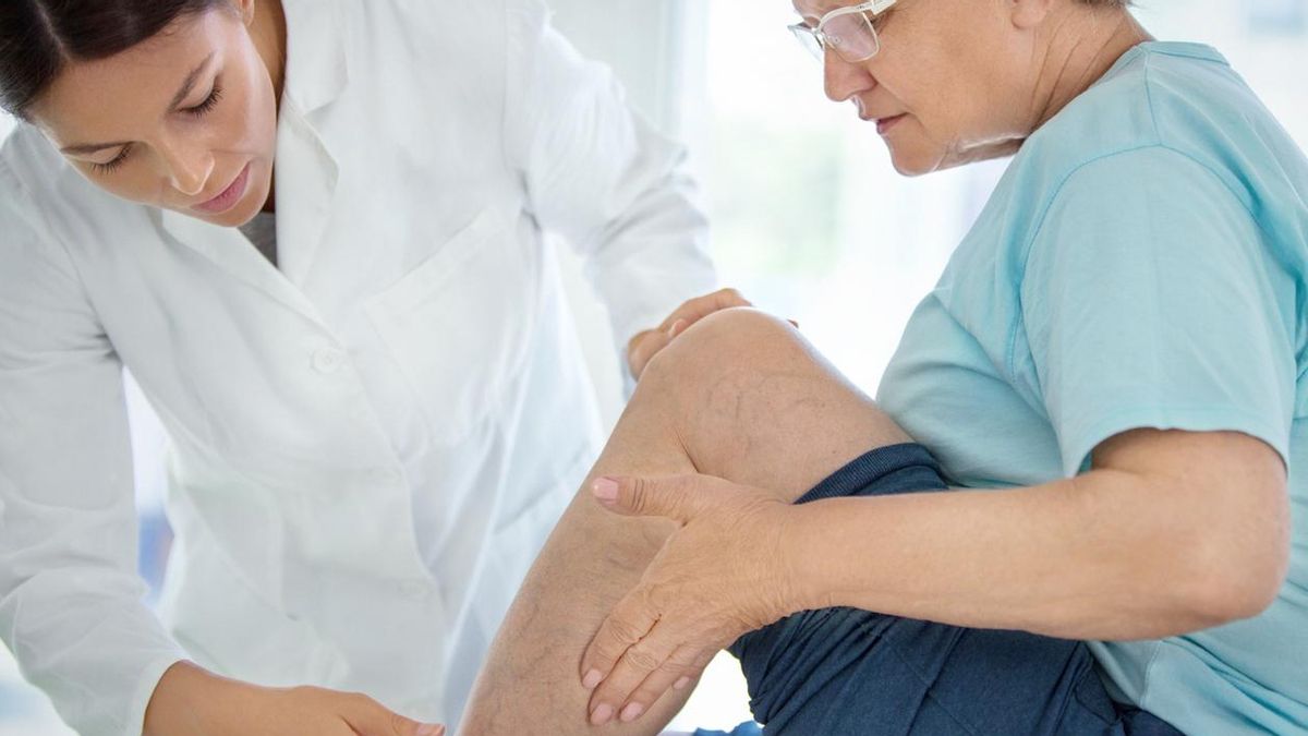 Cómo eliminar las varices después de los 50 años