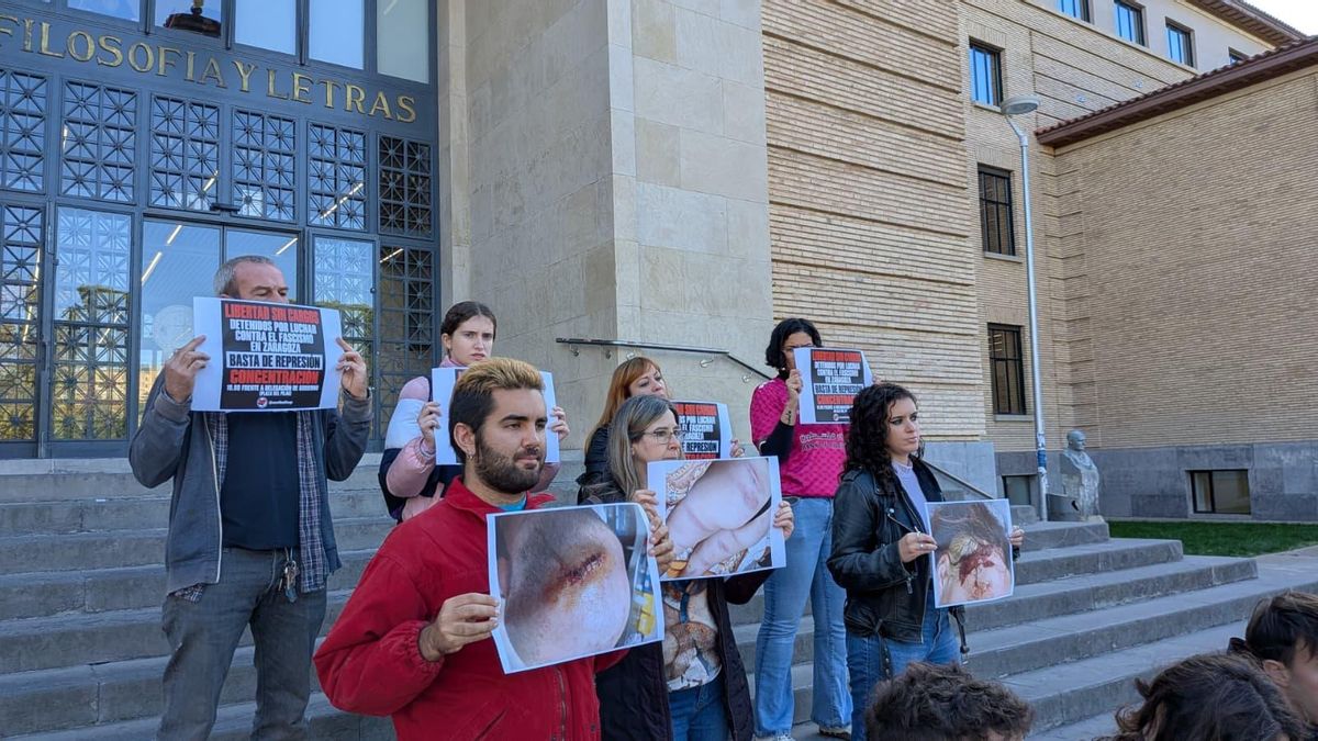 Fotografías de alguna de las lesiones tras las cargas policiales
