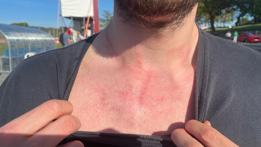 Denunciado el alcalde de un pueblo de Lugo por agredir a un hombre que estaba tocando el bombo en un partido de fútbol