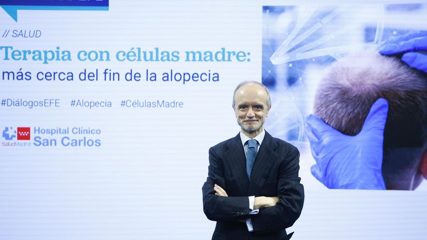 El fin de la alopecia empezará a tratarse en 2030, según el artífice de una nueva terapia
