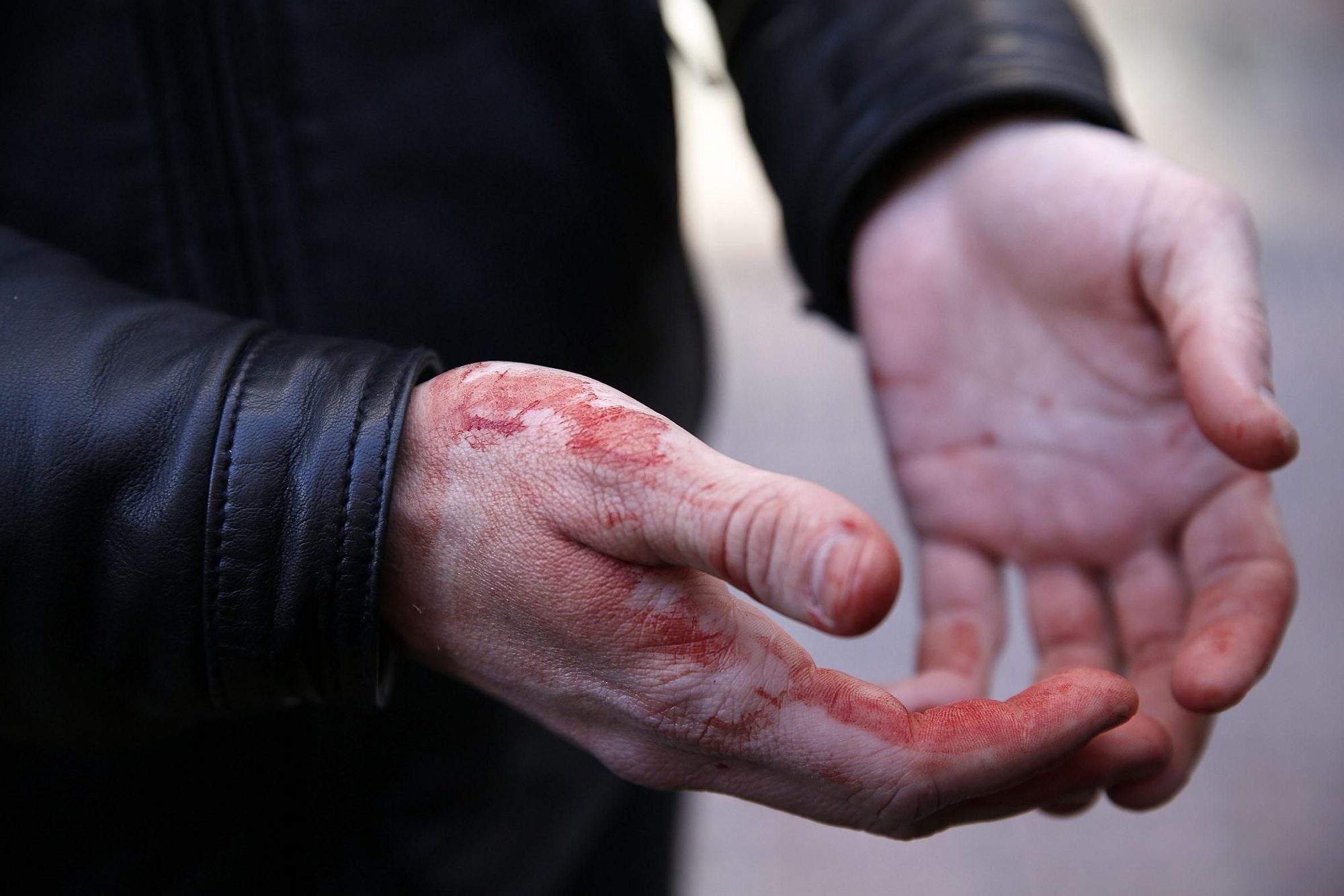 Un activista con las manos llenas de sangre que le brotaba de la nariz. Según afirmó un policía le propinó un puñetazo mientras lo sacaba del patio de la vivienda.