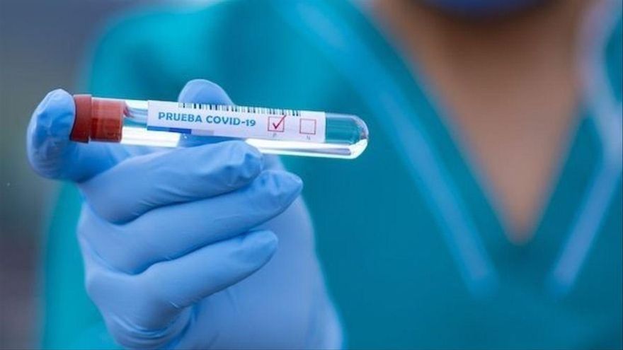 Test PRC para detectar la COVID-19.