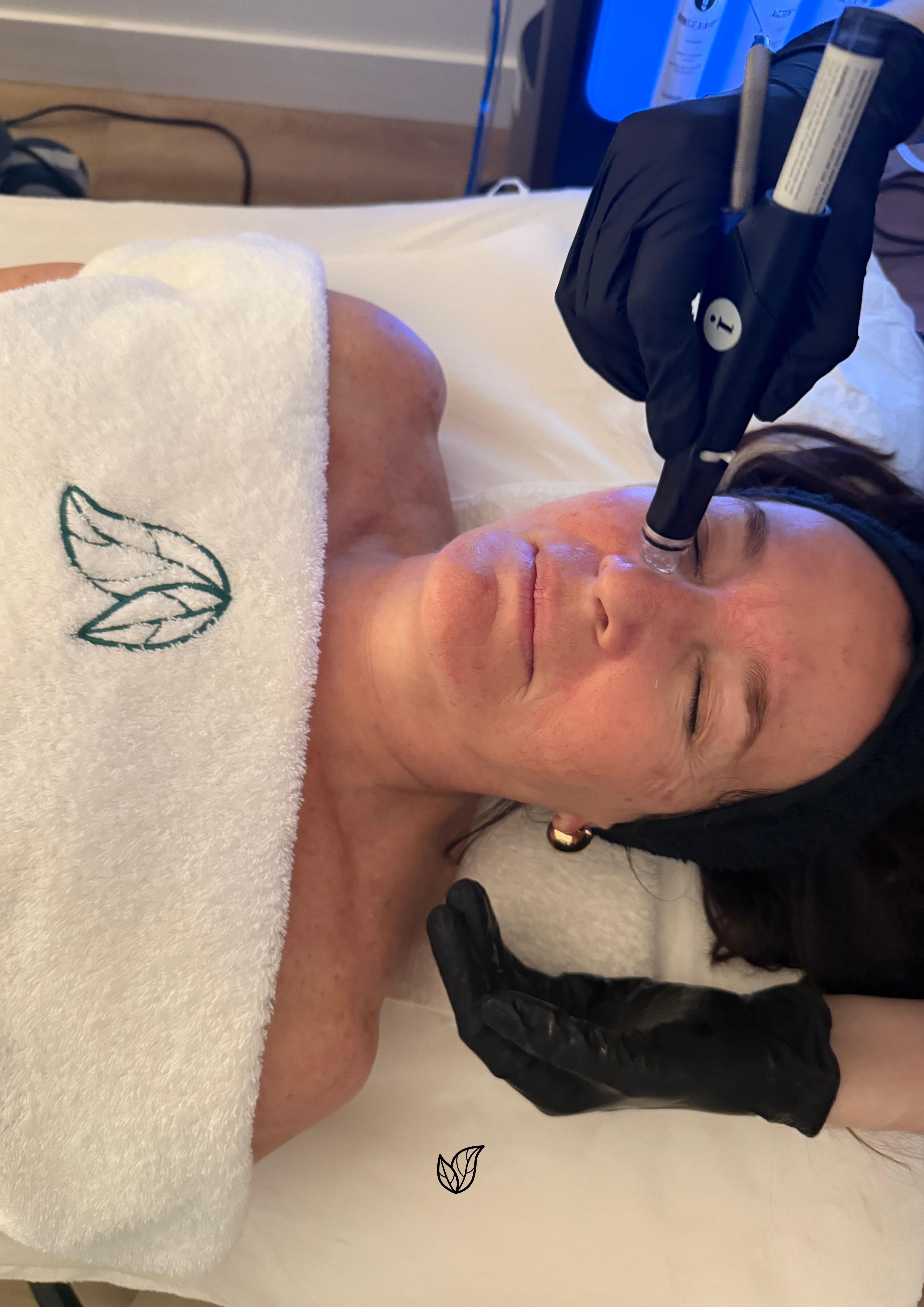 Tratamiento de limpieza Hydrafacial.