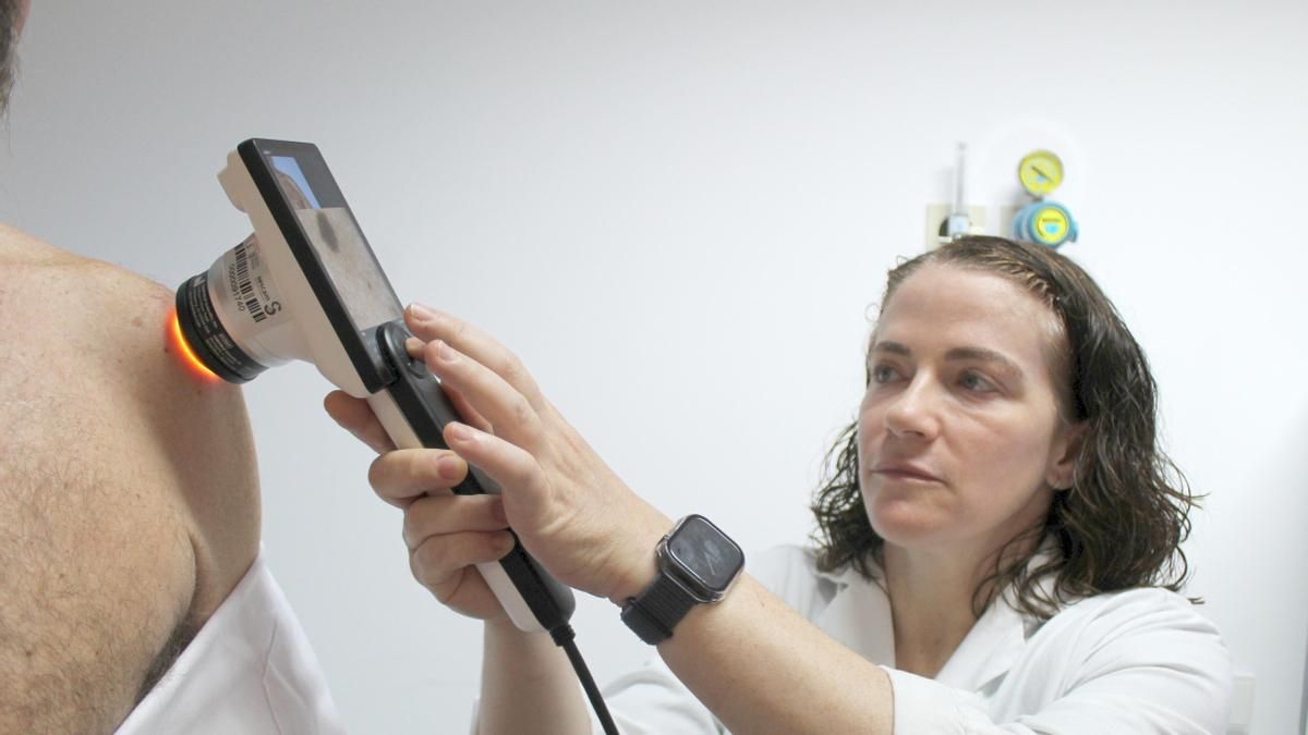 Un nuevo dermatoscopio digital para el Hospital de Ciudad Real de cara a detectar de forma precoz el cáncer de piel
