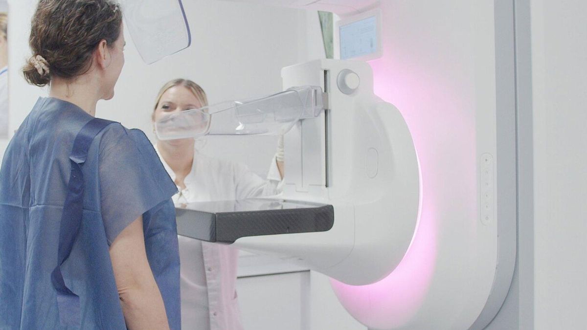 El Hospital San Juan de Dios incorpora dos nuevos equipos para avanzar en detección precoz del cáncer de mama