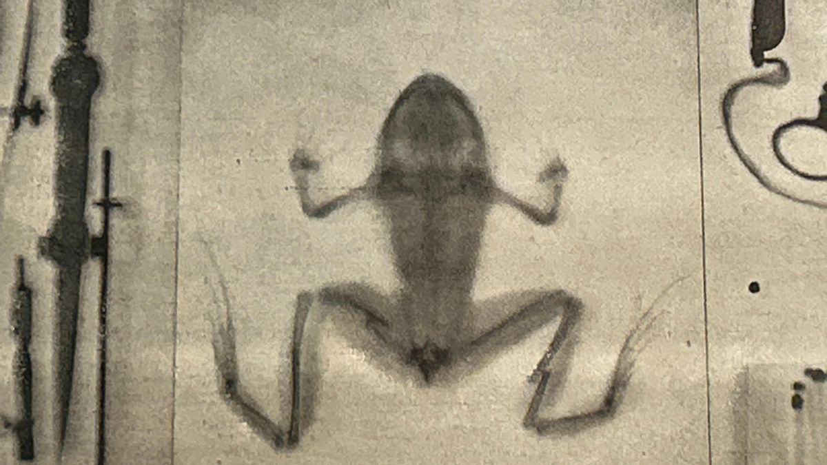 Primera radiografía hecha en España (1896)