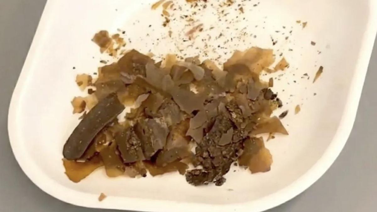 ¿Por qué los romanos elaboraban medicamentos con excrementos humanos? La respuesta estaba enterrada en Turquía