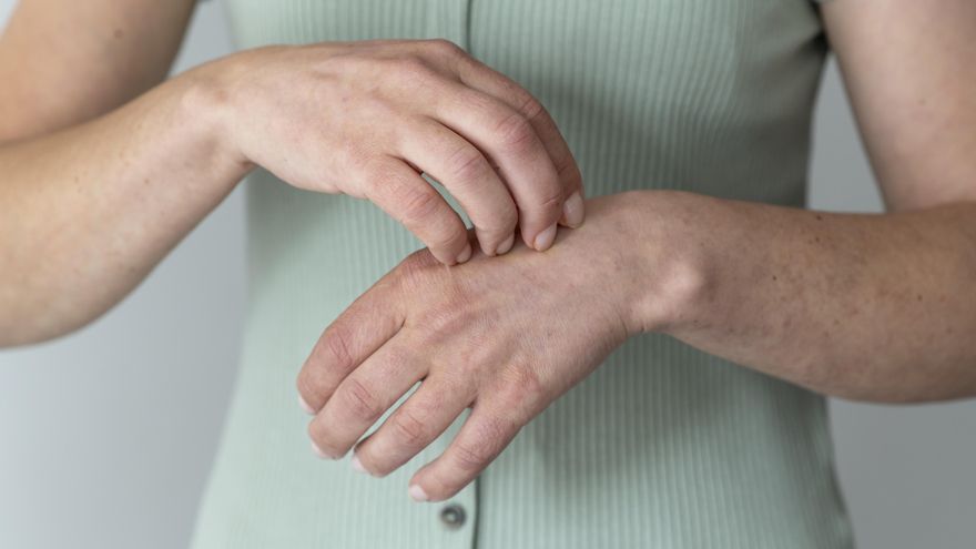 Cómo aliviar las picaduras de mosquitos y otros insectos