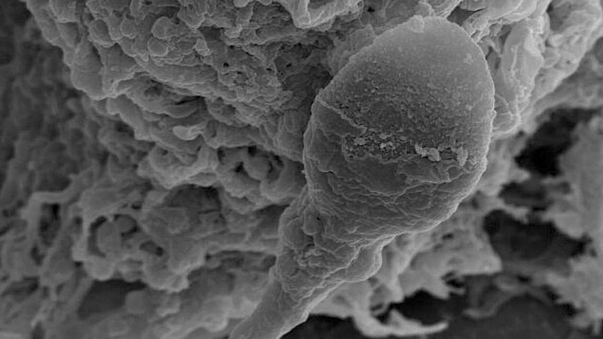 Los espermatozoides se pierden en el espacio: “Realmente no saben qué es arriba o abajo”