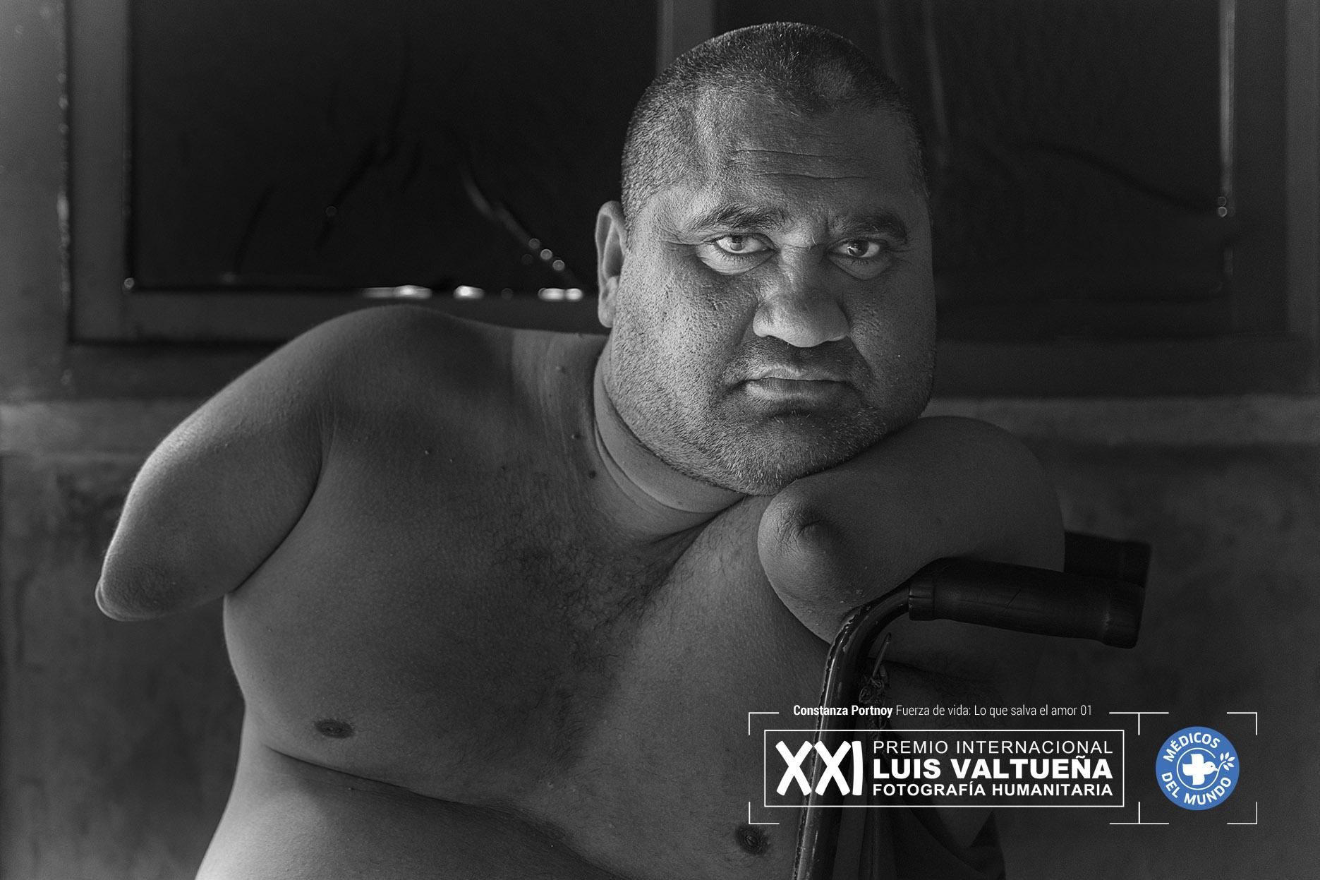 Jorge nació en un pequeño poblado rural de Argentina hace 37 años. Tiene una malformación congénita que le afecta sus cuatro extremidades debido a un medicamento con talidomida que le administraron a su madre un año antes de su nacimiento por fuera de cualquier protocolo de farmacovigilancia. Foto: Constanza Portnoy: Fuerza de Vida, lo que salva el amor. Primera finalista.