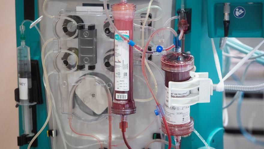 El Vall d'Hebron ensaya un filtro sanguíneo para tratar a críticos de COVID-19