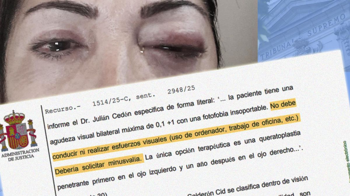 Obligada a trabajar pese a su ceguera legal: una sentencia revoca la incapacidad permanente de una mujer de Sevilla