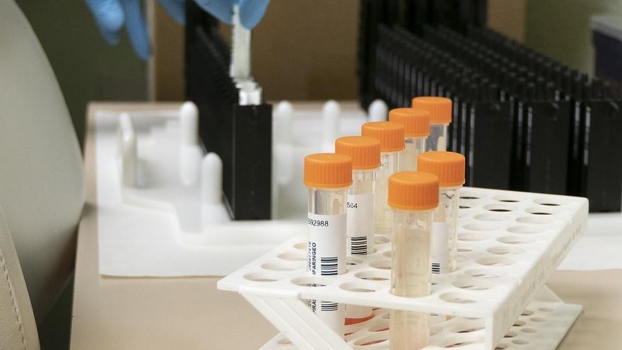 Investigación de viruela del mono.