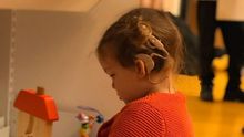 Olalla, con un implante coclear que le permite oír