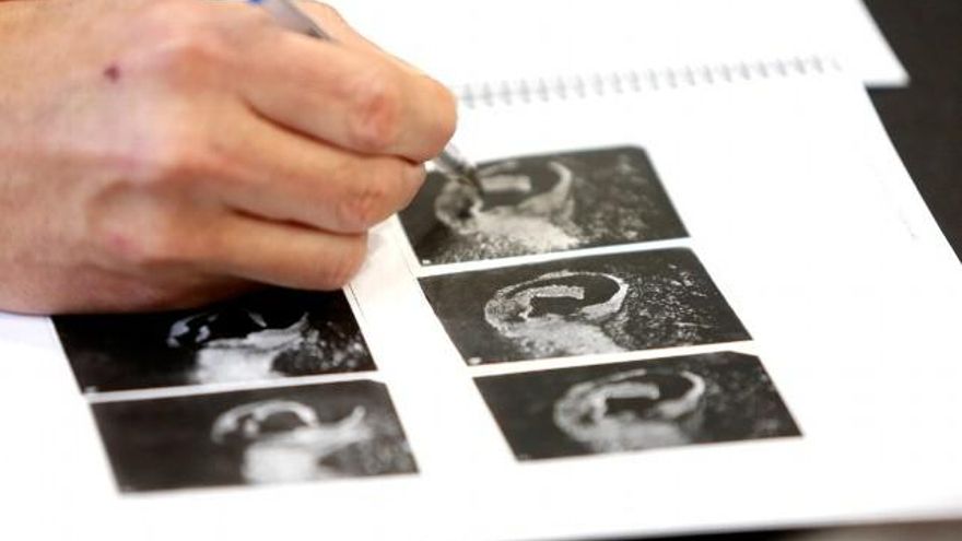 El otograma consiste en la identificación de un individuo mediante la obtención de huellas de una oreja. / Carlos S. Campillo / ICAL