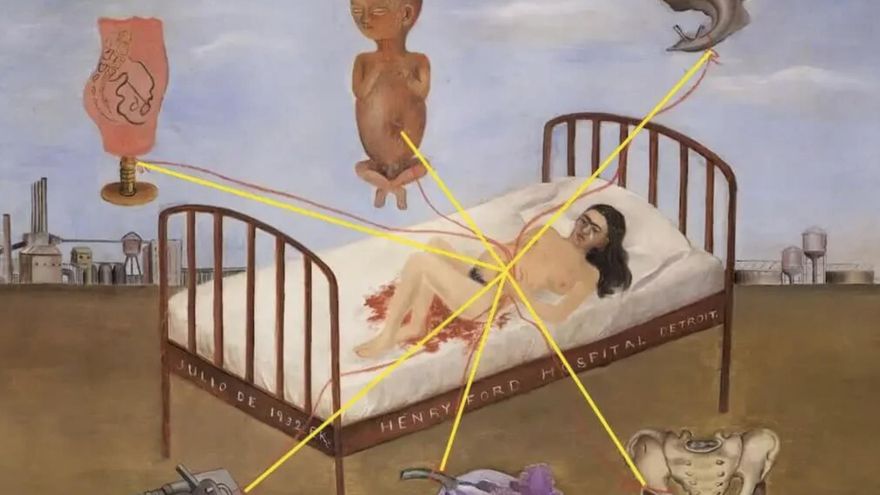 Frida Khalo no superó su incapacidad para tener hijos