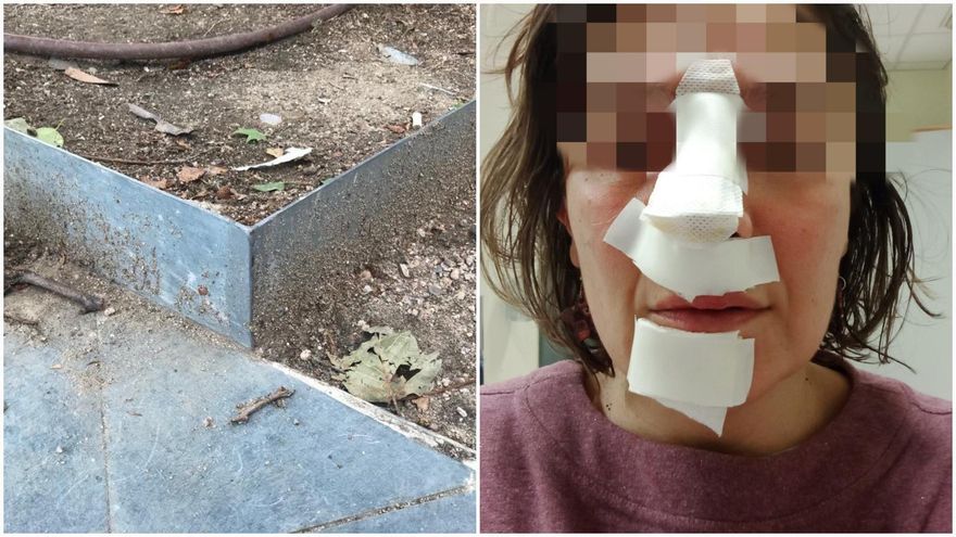 El bordillo de un parque de Chamberí que ha llevado al hospital a varias personas: "Es un foco de accidentes"