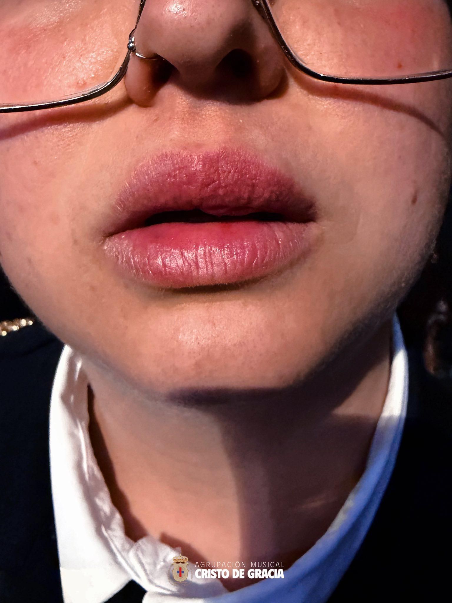 Estado en el que quedó el labio de la música tras el golpe.