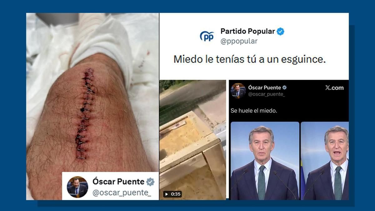 El PP se burla de una lesión de Óscar Puente y el ministro responde: "Son la peor gentuza que habita este país"