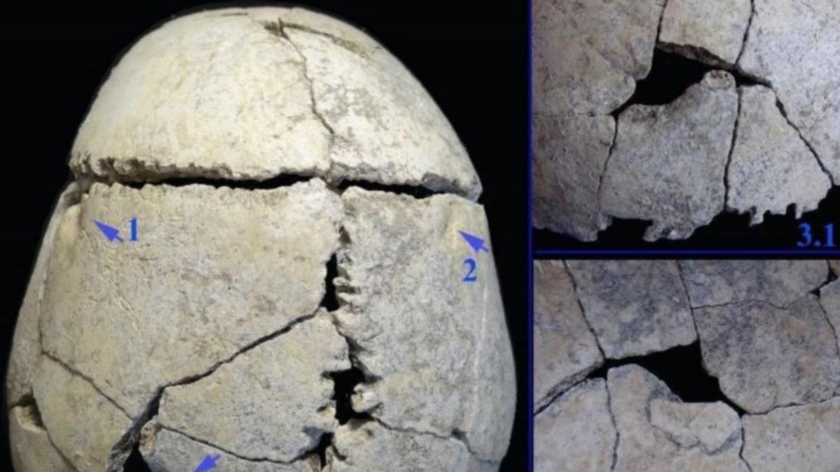 Las marcas del cráneo y otras fracturas encajaban con dentaduras de león