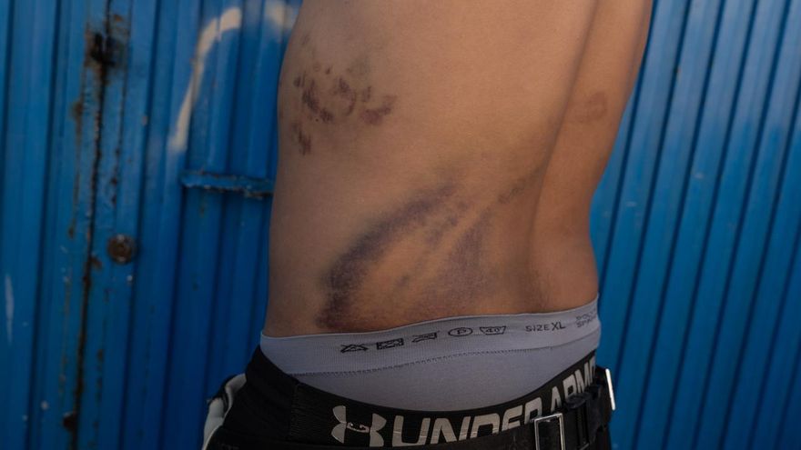 Las palizas de militares a migrantes en Ceuta continuaron después de que Defensa conociese decenas de denuncias