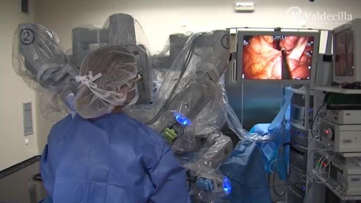 Sanidad impulsa la cirugía robótica en Valdecilla con un nuevo robot Da Vinci