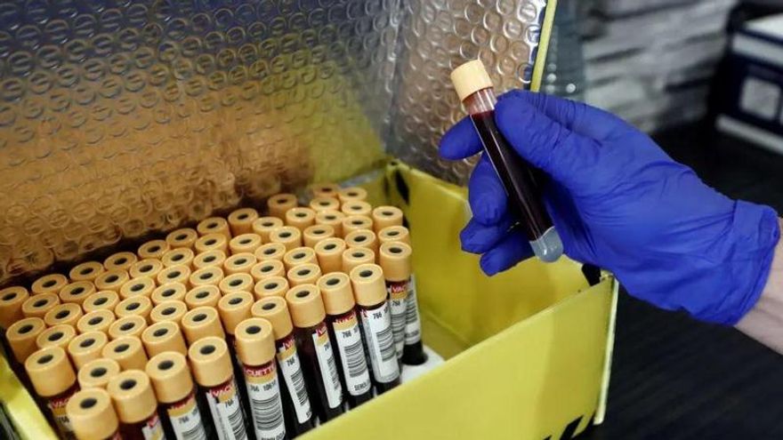 Un análisis de sangre permite diagnosticar el alzhéimer con una precisión del 95%