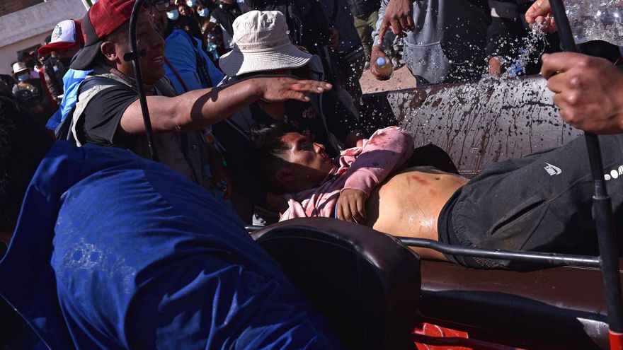 Mueren 17 manifestantes en la jornada más sangrienta de protestas en Perú