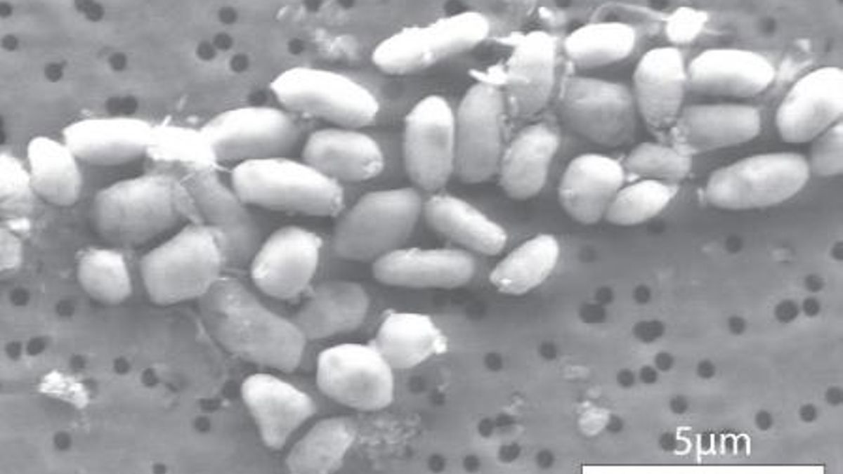 Imagen de la bacteria GFAJ 1.