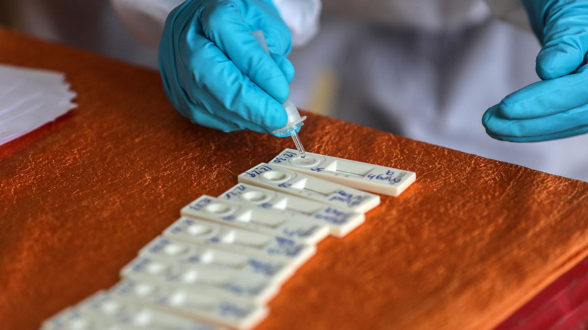 Investigadores de la Universidad de Kyushu, en el sudoeste de Japón, y un fabricante de equipos médicos del país han desarrollado un test de anticuerpos de la COVID-19 usando gusanos de seda. EFE/EPA/DIVYAKANT SOLANKI