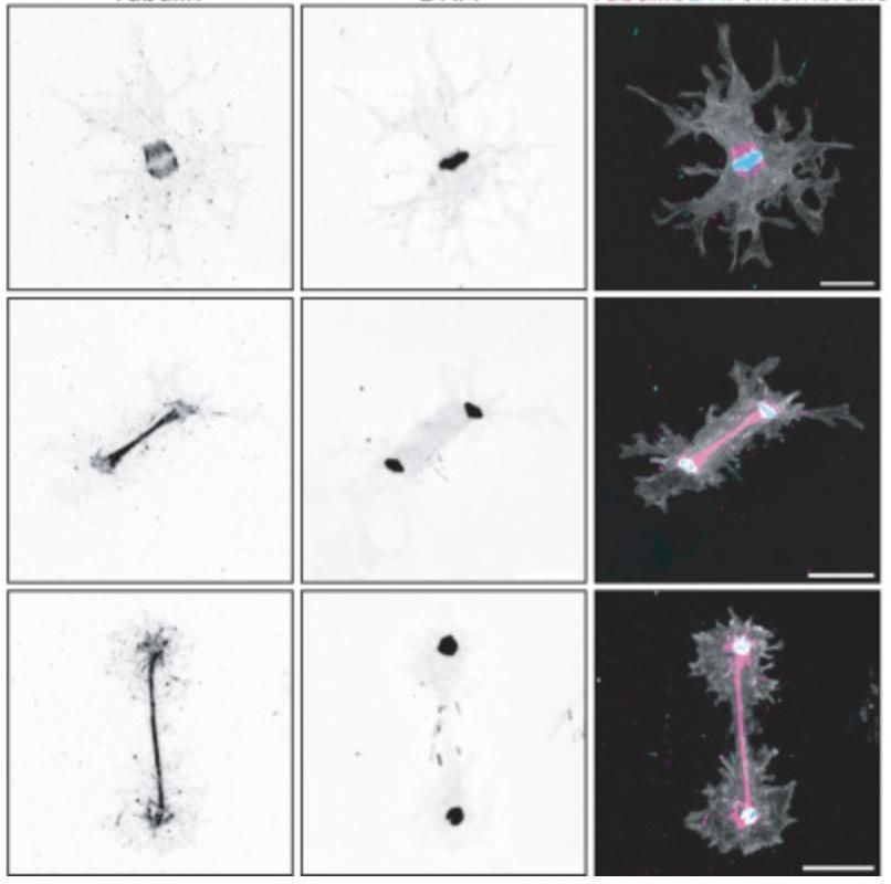 La 'Incendiamoeba cascadensis' durante su reproducción celular