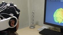 neuroestiulación