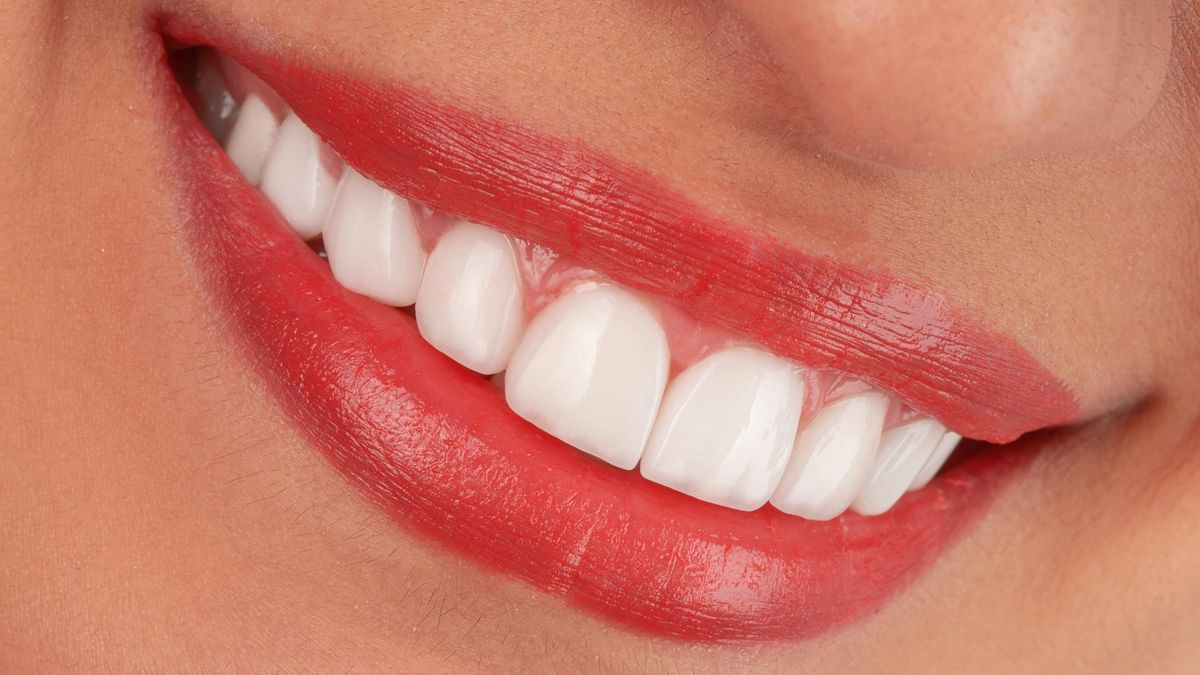 El dentista Julián Saiz aclara los riesgos de las carillas dentales: “No aconsejo poner carillas en caso de apiñamiento severo”