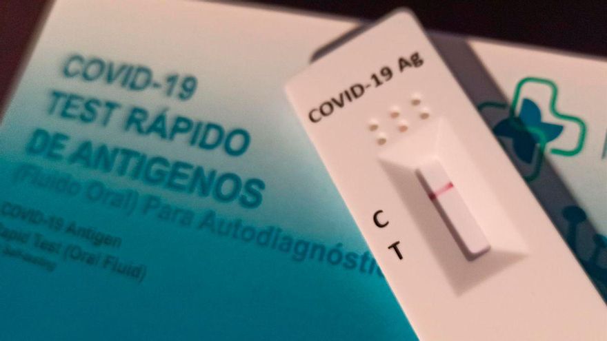 El PSOE envía a la Fiscalía el contrato de 8.000 test de Covid comprados por Sadeco