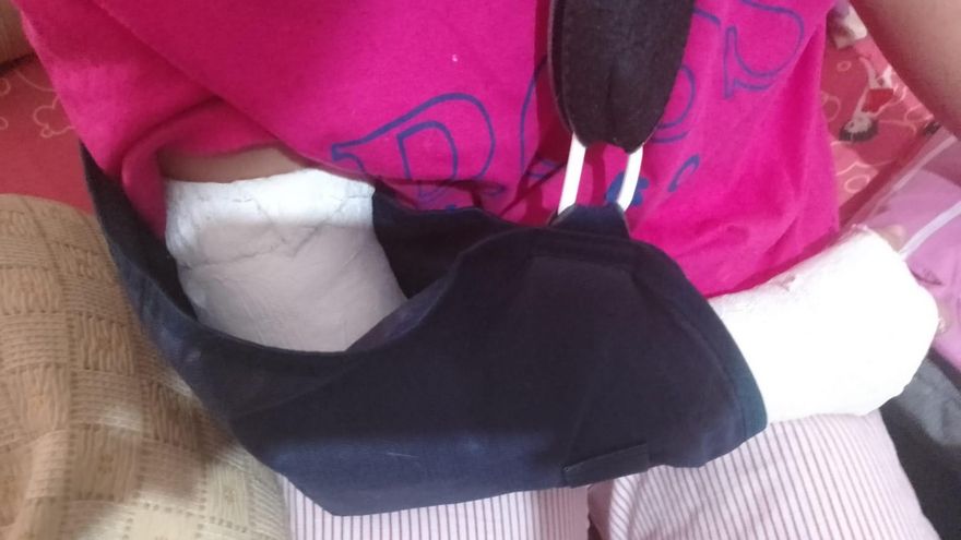 La pequeña accidentada se ha roto la muñeca y presenta magulladuras por todo el cuerpo