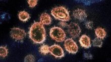 Imagen del virus SARSCov-2 que provoca COVID-19 / NIAID.