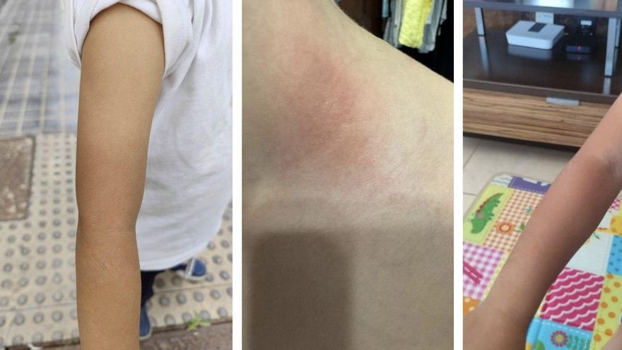 Insolaciones, quemaduras y sin salir al patio en olas de calor: las familias del Colegio Bañaderos piden zonas de sombra