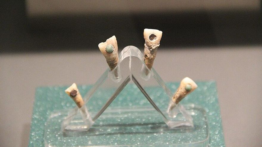 Dientes humanos con incrustaciones de la cultura maya clásica.