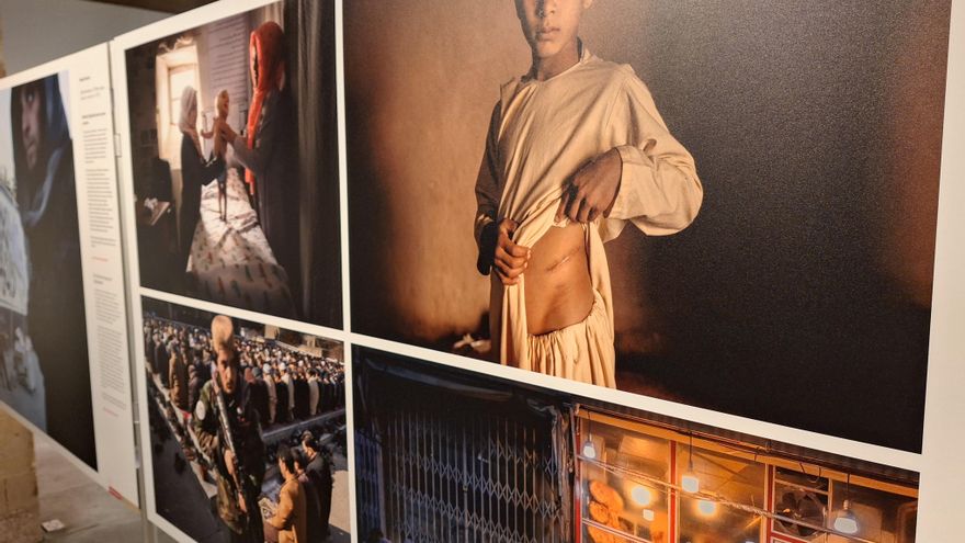 World Press Photo en Vitoria: venta de riñones, un 'no' al hiyab y otras historias rescatadas por el fotoperiodismo