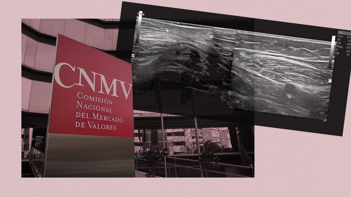 Trabajadoras con lipoatrofia semicircular en la CNMV: “Nos obligan a ir al lugar que nos está enfermando”