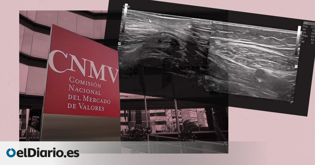 Trabajadoras con lipoatrofia semicircular en la CNMV: “Nos obligan a ir al lugar que nos está enfermando”