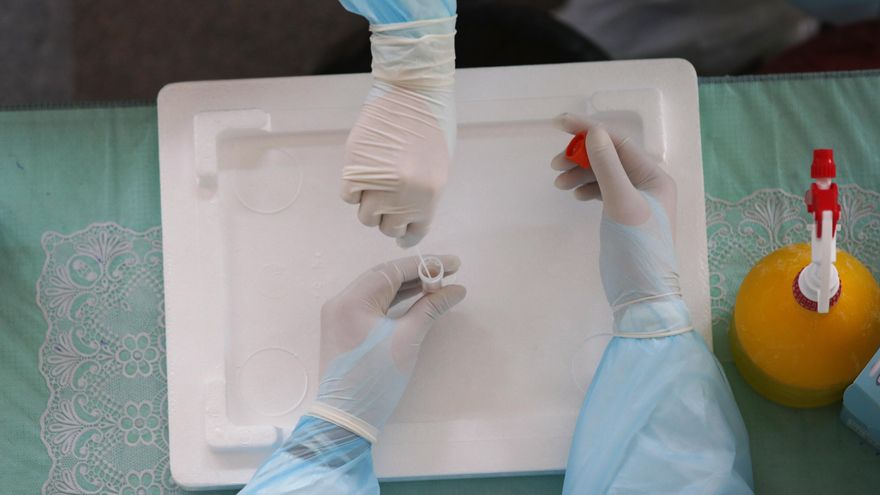 Una prueba PCR. EFE/EPA/RUNGROJ YONGRIT/ Archivo