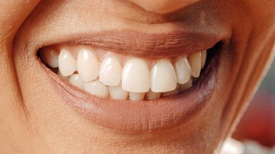 Terapia láser para la sensibilidad dental: más luces que sombras